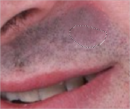 Use the Patch Tool to find a good area of skin to copy Use-the-Patch-Tool-to-find-a-good-area-of-skin-to-copy