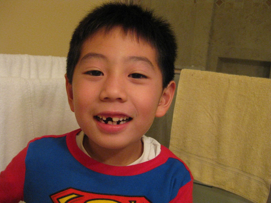 [missing_tooth4%255B3%255D.jpg]
