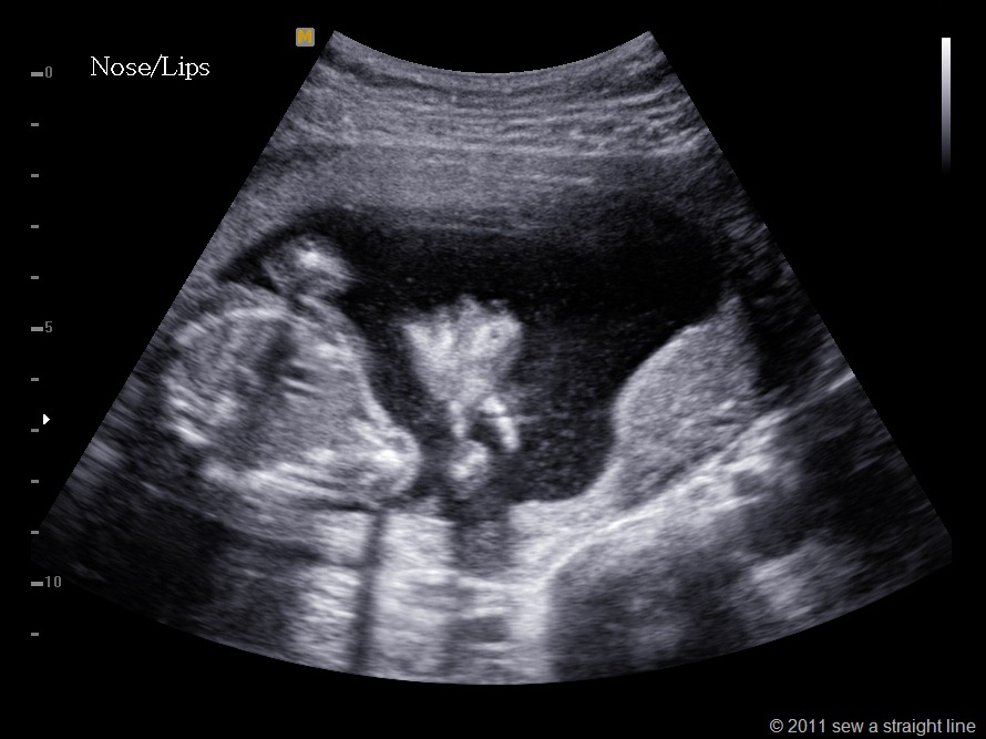 [BABY%2520GUBLER_0017%255B7%255D.jpg]