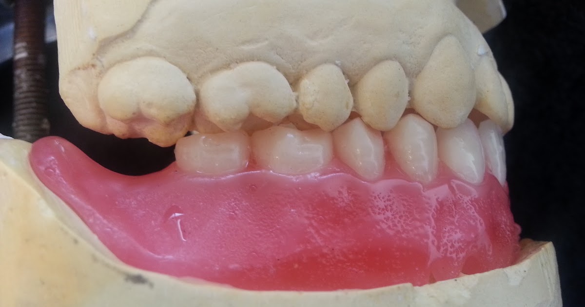 Mrs D's Dental Technology space for student Try in and wax up of a