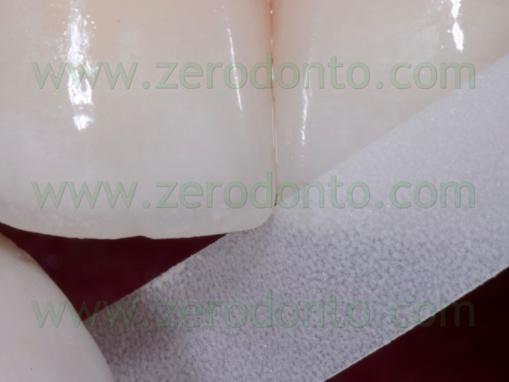 [120-strip-abrasive-rifinitura-interd%255B1%255D.jpg]
