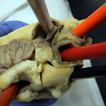 heart_vessels_external_closer.JPG