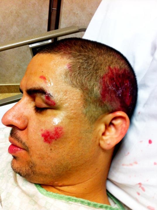 larry hernandez accidente fotos 0001