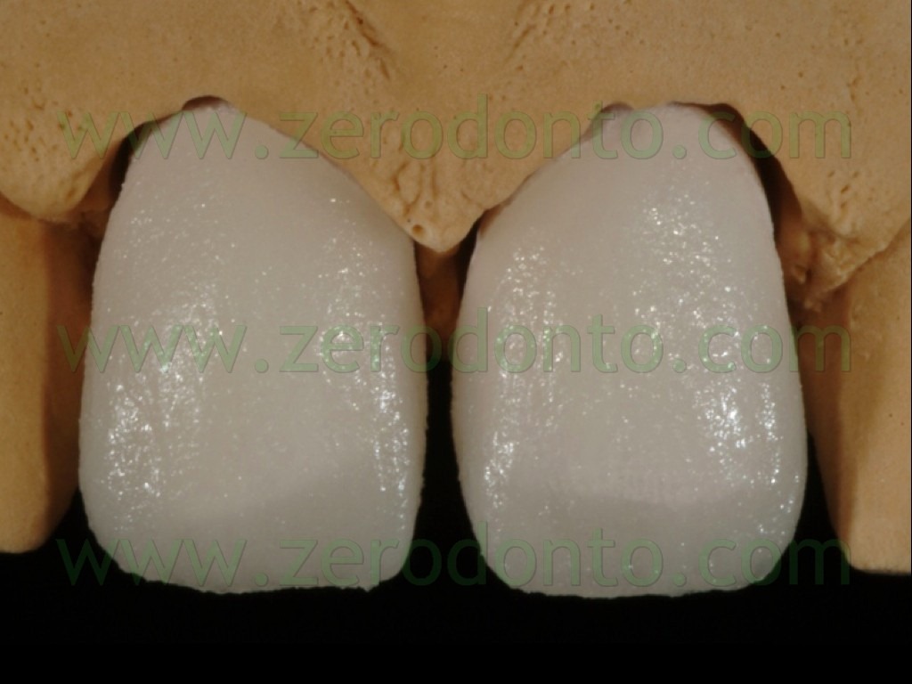 [89-stratificazione-ceramica-massa-sm%255B2%255D.jpg]
