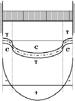 Cordones comprimidos y traccionados de las vigas.