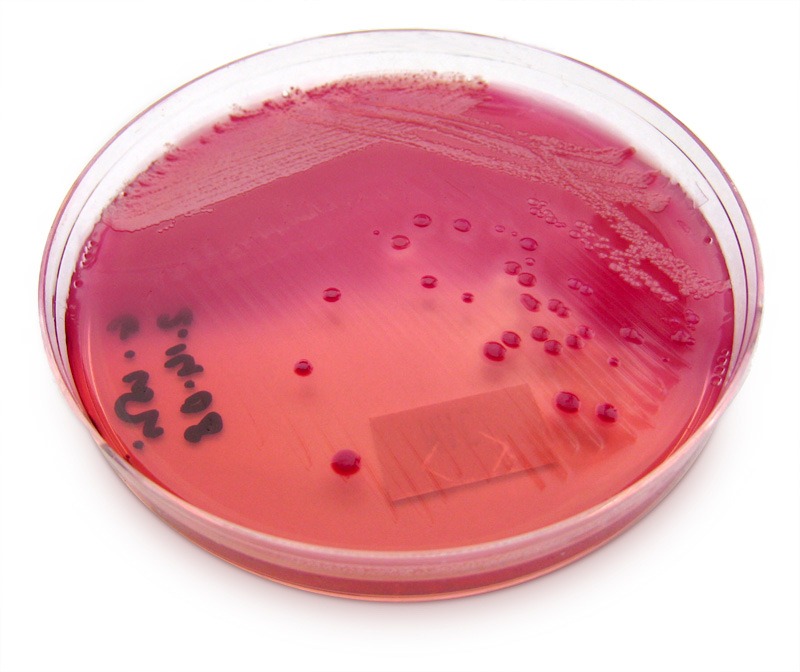 E. coli em ágar MacConkey. Crédito: Michigan State University