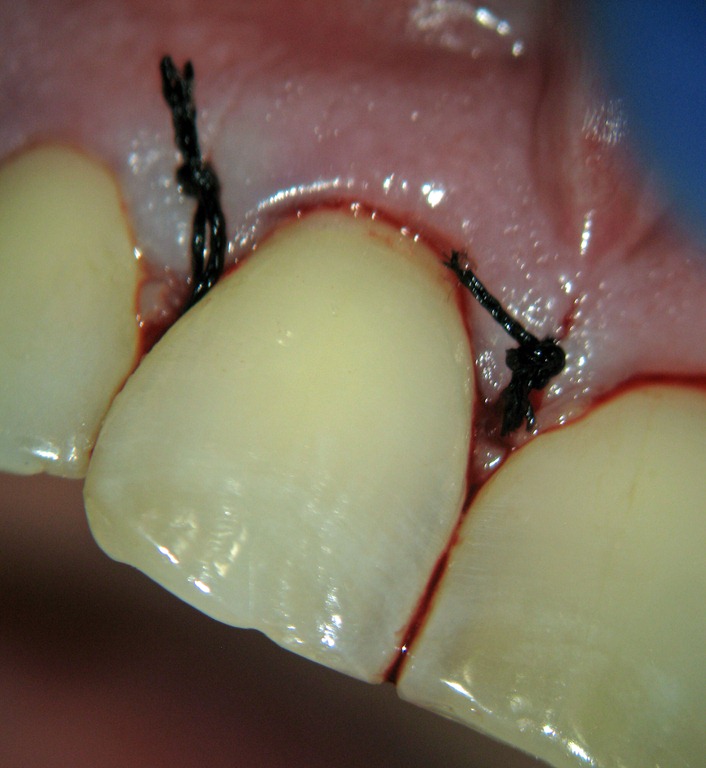 [Sutures%2520pic021%255B3%255D.jpg]