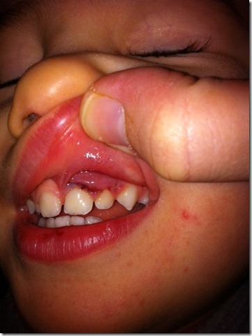 rams teeth