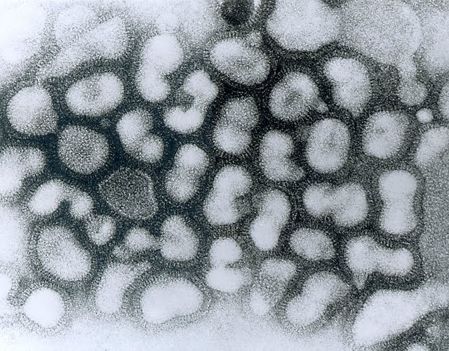 -Influenza_A_-_late_passage.jpg