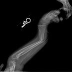 Looking onto the "edge" of her arm. This one make my stomach hurt a little just looking at it.