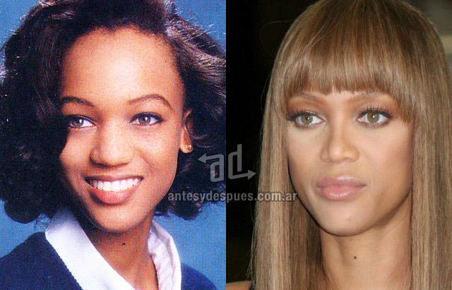 La nueva nariz operada de Tyra Banks