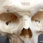 zygomatic_labeled.JPG