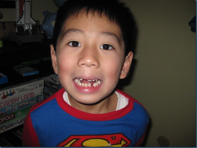 missing_tooth5