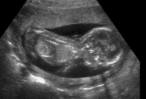 [baby%2520boy%252016%2520weeks%2520020412%2520%25282%2529%255B3%255D.jpg]