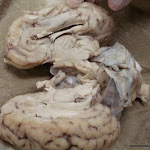 brain_dissect19.jpg brain_dissect19.jpg