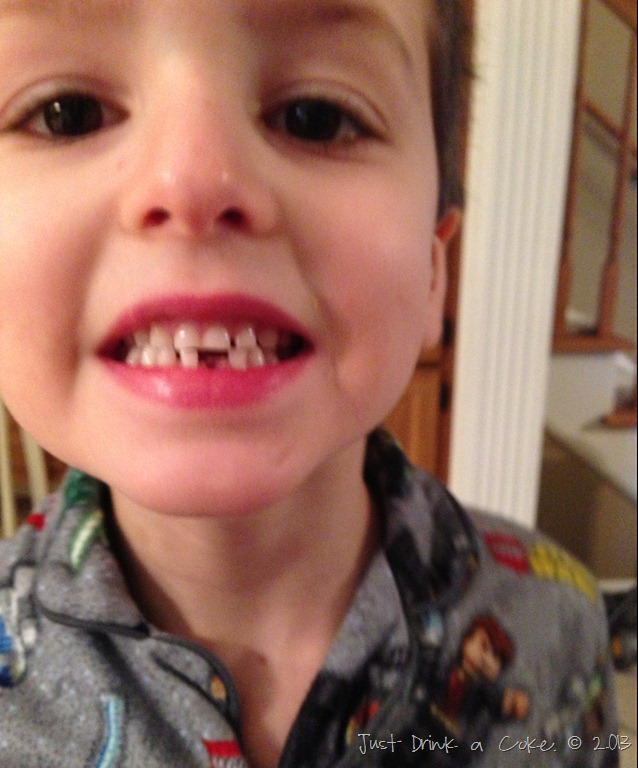 [losing%2520a%2520tooth%25201%255B6%255D.jpg]
