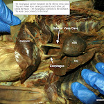 esophagus_vena_L.JPG