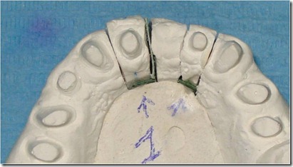 ortodonzia provvisorio guidata