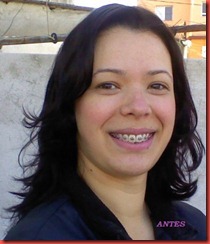 Antes Antes