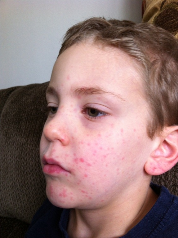 [rash2%255B4%255D.jpg]