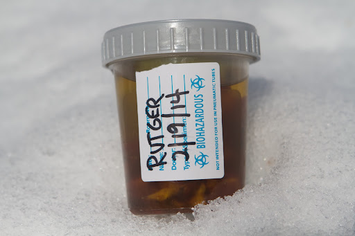 The surgery took three-and-a-half hours. The nice horse dentist put the tooth in special liquid in this container and labeled it for us. The surgery took three-and-a-half hours. The nice horse dentist put the tooth in special liquid in this container and labeled it for us.