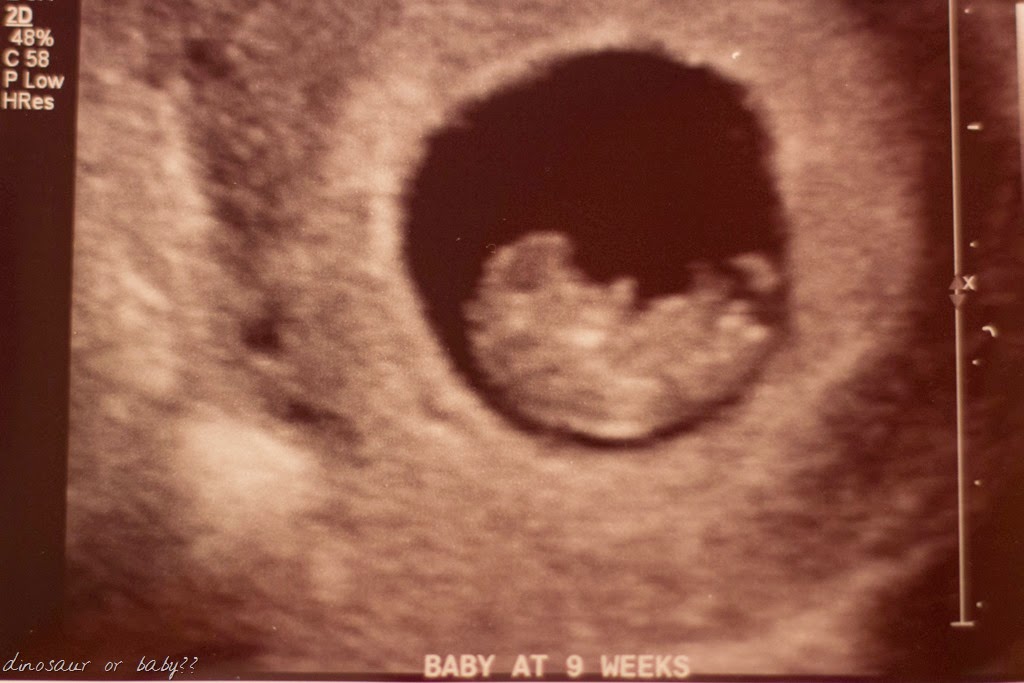 [IMG_1056%255B12%255D.jpg]