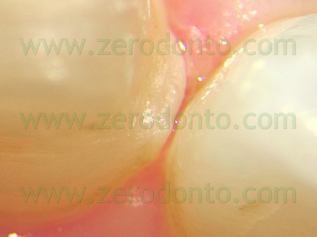 [102-precisione-faccette-tessuti-paro.jpg]