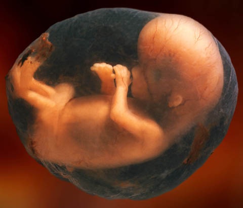 [8-week-unborn-baby%255B2%255D.jpg]