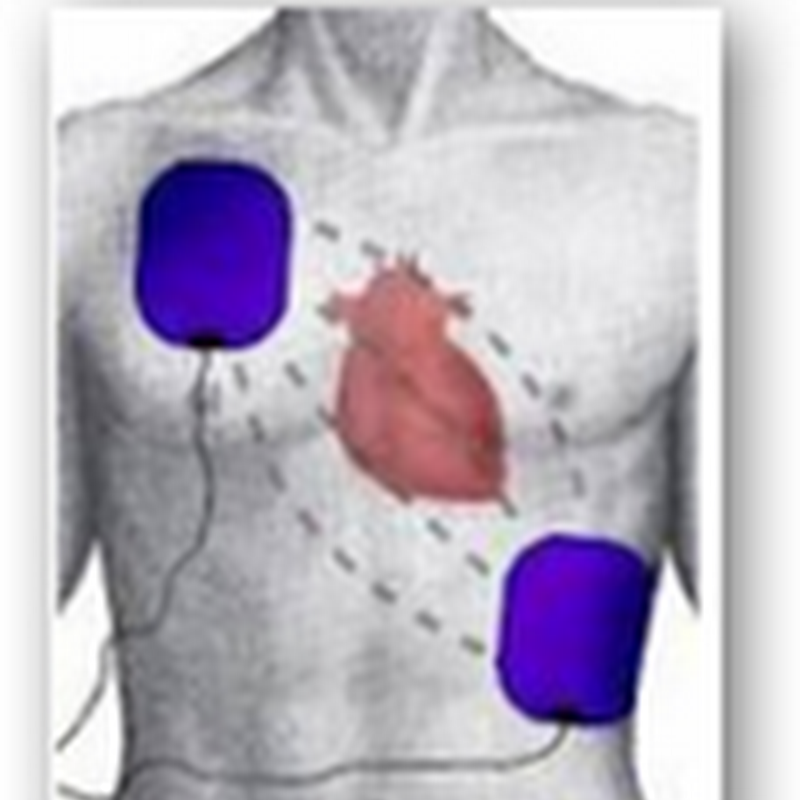 Hospitals To Get E-Mails From Department of Justice To Examine Questionable Defibrillator Surgeries With Medicare Patients–What A Waste As DOJ Time Is Better Spent With Analytics For Wall Street/Banker Crimes