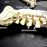 spinous_lumbar_labeled.JPG