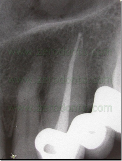 FIG N 25