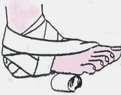 bandage spiral du pied