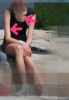 Anorexic to Fit Personal Picture 2