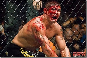 UFC_BLOOD MMA VIOLENCE