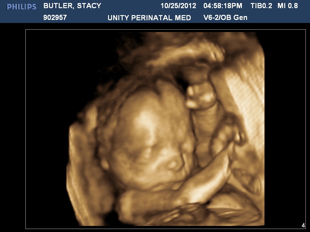 [BUTLERSTACY20121025165819070%255B3%255D.jpg]