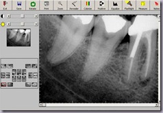 digital-dental-xrays