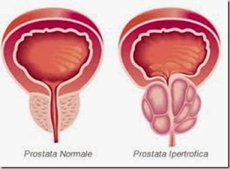 iperplasia prostatica benigna cane