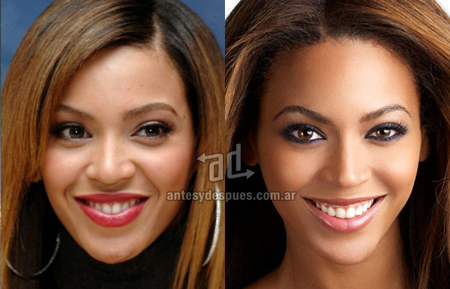 La nueva nariz operada de Beyonce