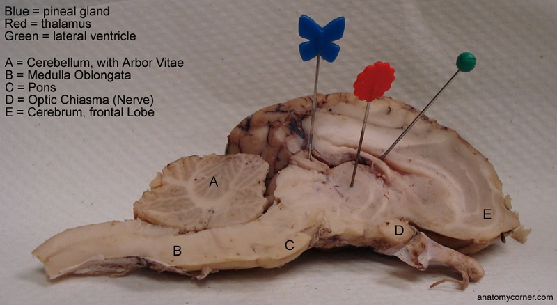 annonce rencontre lausanne