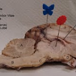 brain_dissect21.jpg brain_dissect21.jpg