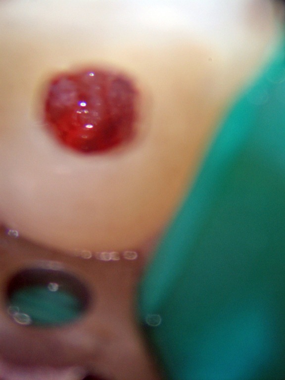 [engorged%2520pulp004%255B3%255D.jpg]