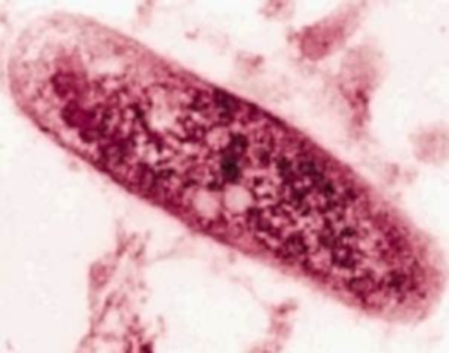 tuberculosis (1) tuberculosis (1)