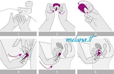 [meluna-inserimento%255B9%255D.jpg]