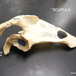 glenoid_labeled.JPG