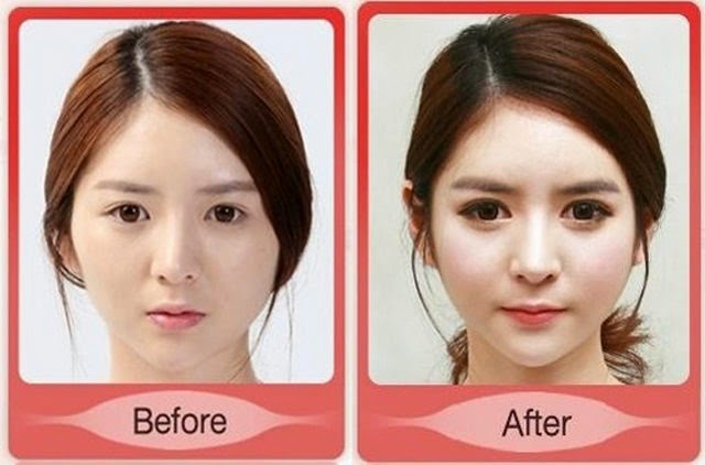 [korean-plastic-surgery-24%255B2%255D.jpg]