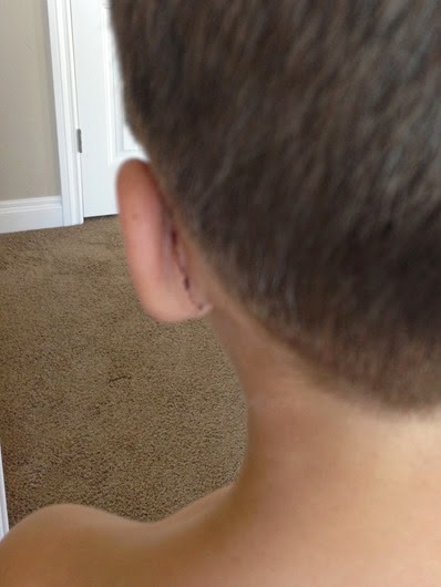 [iPhone%2520Matt%2527s%2520Surgery-20%255B3%255D.jpg]