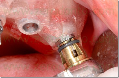 blog.098 blog.098