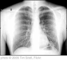 'x-ray' photo (c) 2008, Tim Snell - license: http://creativecommons.org/licenses/by-nd/2.0/