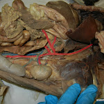 splenic_artery_traced.JPG