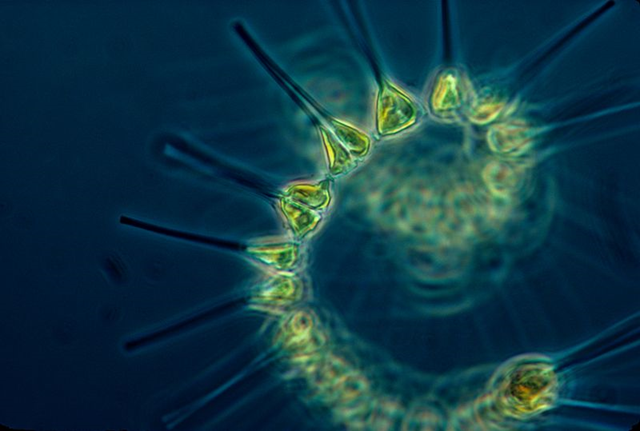 Phytoplankton comprise the foundation of the oceanic food chain. Photo: NOAA MESA Project / Wikipedia